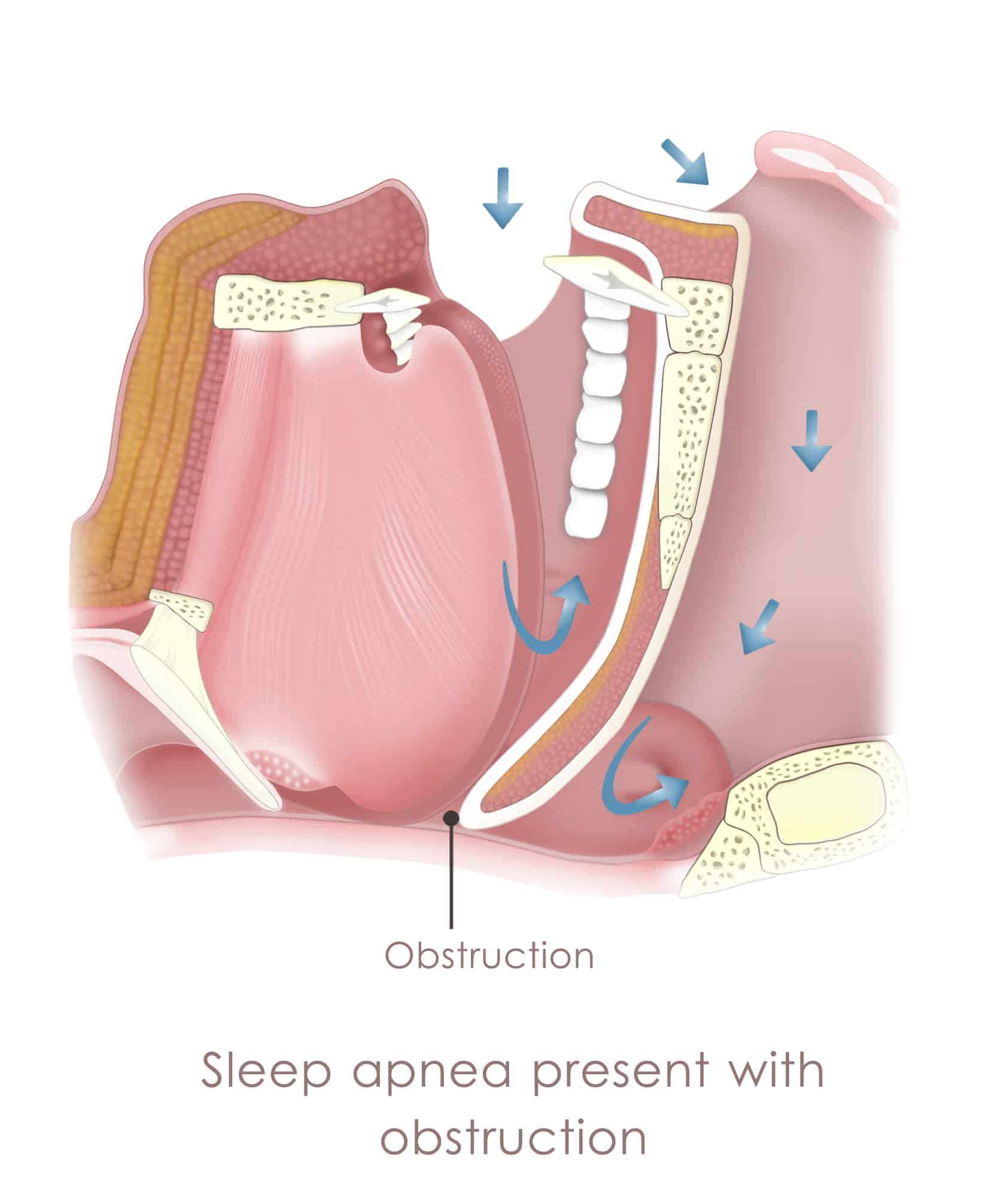 Sleep Apnea Treatments Lansing, MI